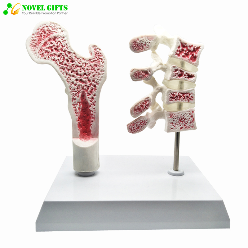 Anatomical Human Osteoarthritis Bone Model